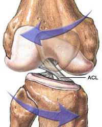 aclinjury